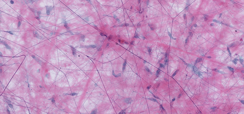 <p>Name the Tissue?</p>