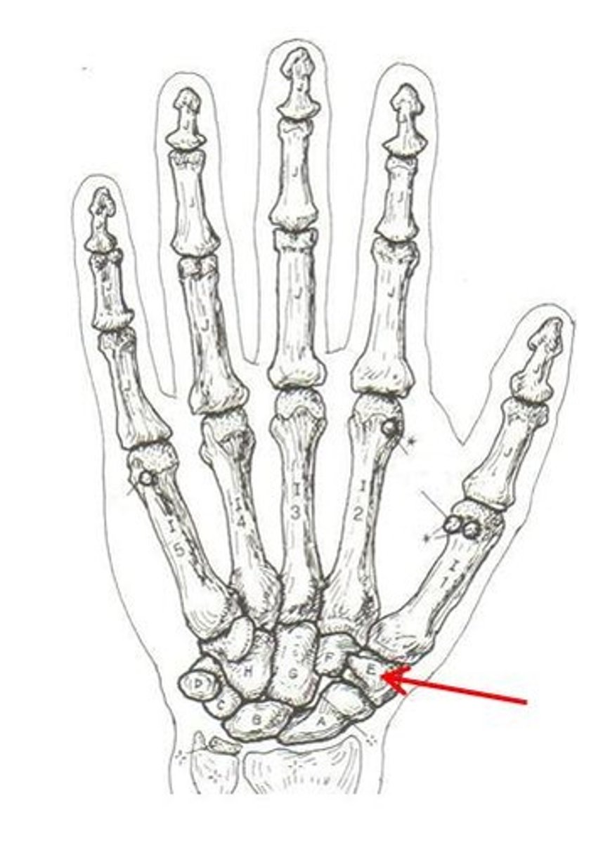 <p>ID bone</p>