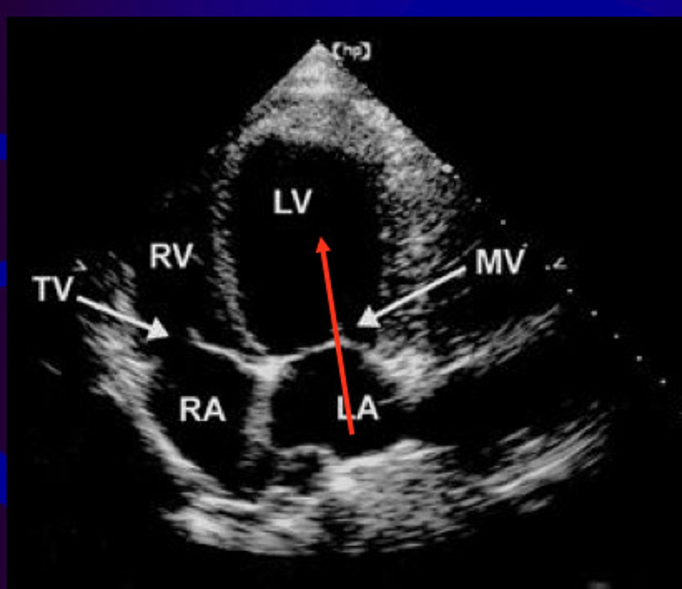 <p>A4 is used to visualize _____ and ____</p>