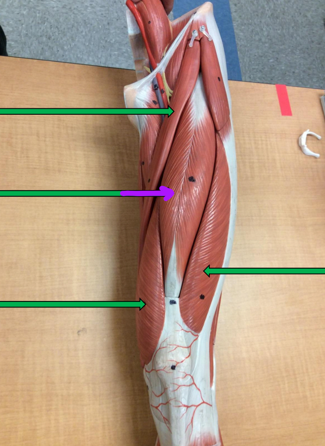 <p>Identify this muscle?</p>