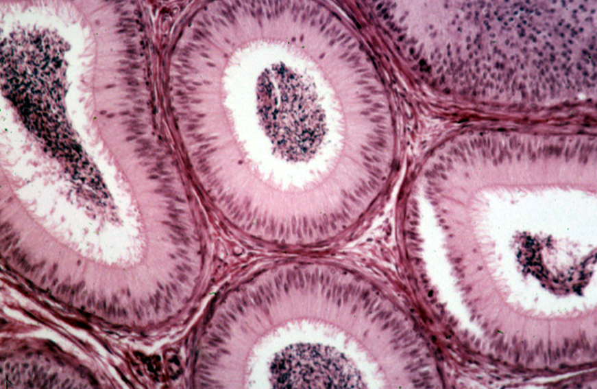 <p>Epididymis</p>