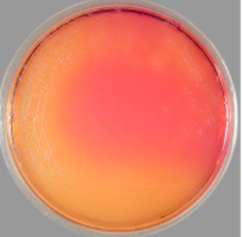 <p>To identify E. Coli 0157:H7. The colonies appear NLF and colorless.</p>