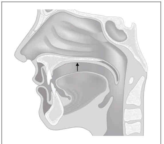 <p>What is the place of articulation? (Tongue body to hard palate)</p>