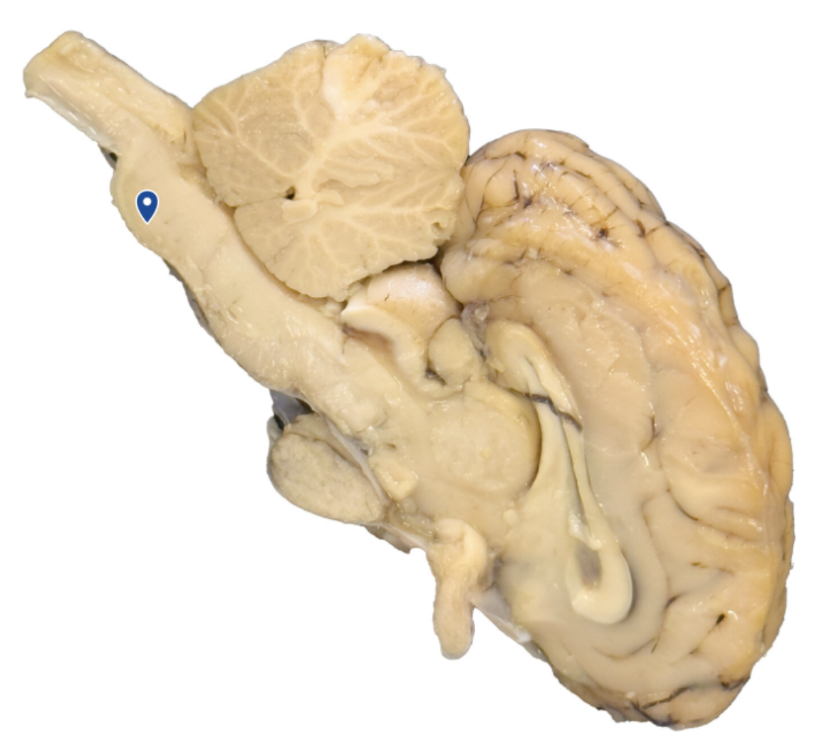 <p>Name this part of the brainstem</p>