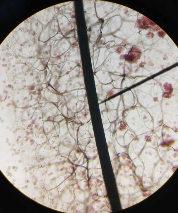 <p>distinctive genus of slime molds found throughout the world; they are characterized by the tall brown sporangia, supported on slender stalks, which grow in clusters on rotting wood.</p>