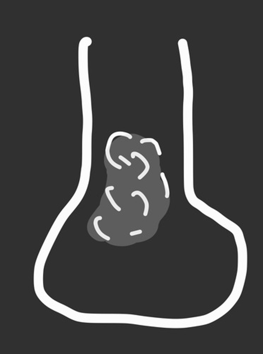 <p>painful</p><p>what does this represent?</p>