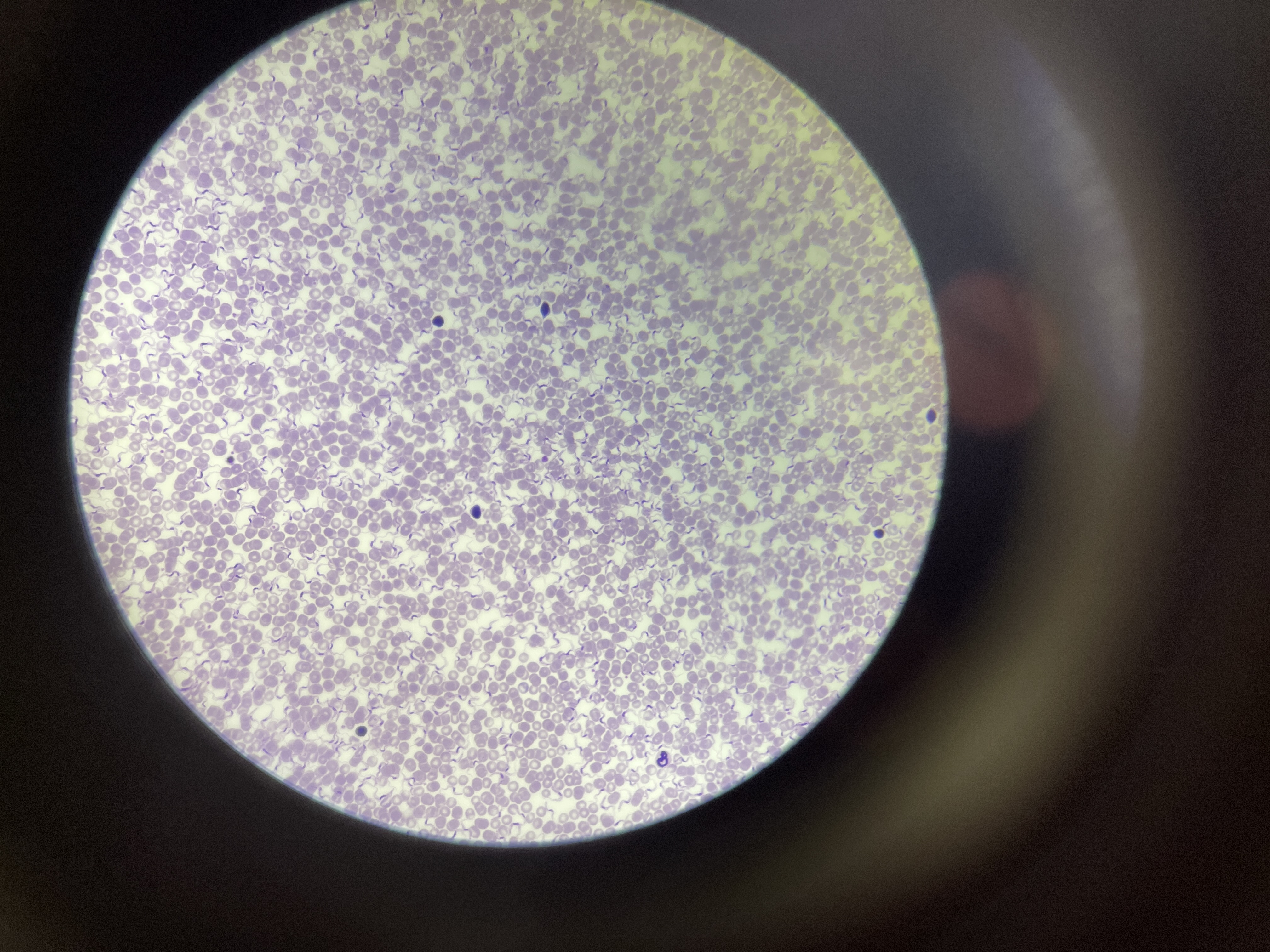 <p>Trypanosoma Cruzi </p>