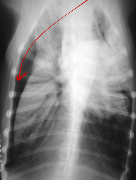 <p>What condition? </p>