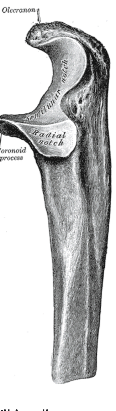 <p>radial notch</p>