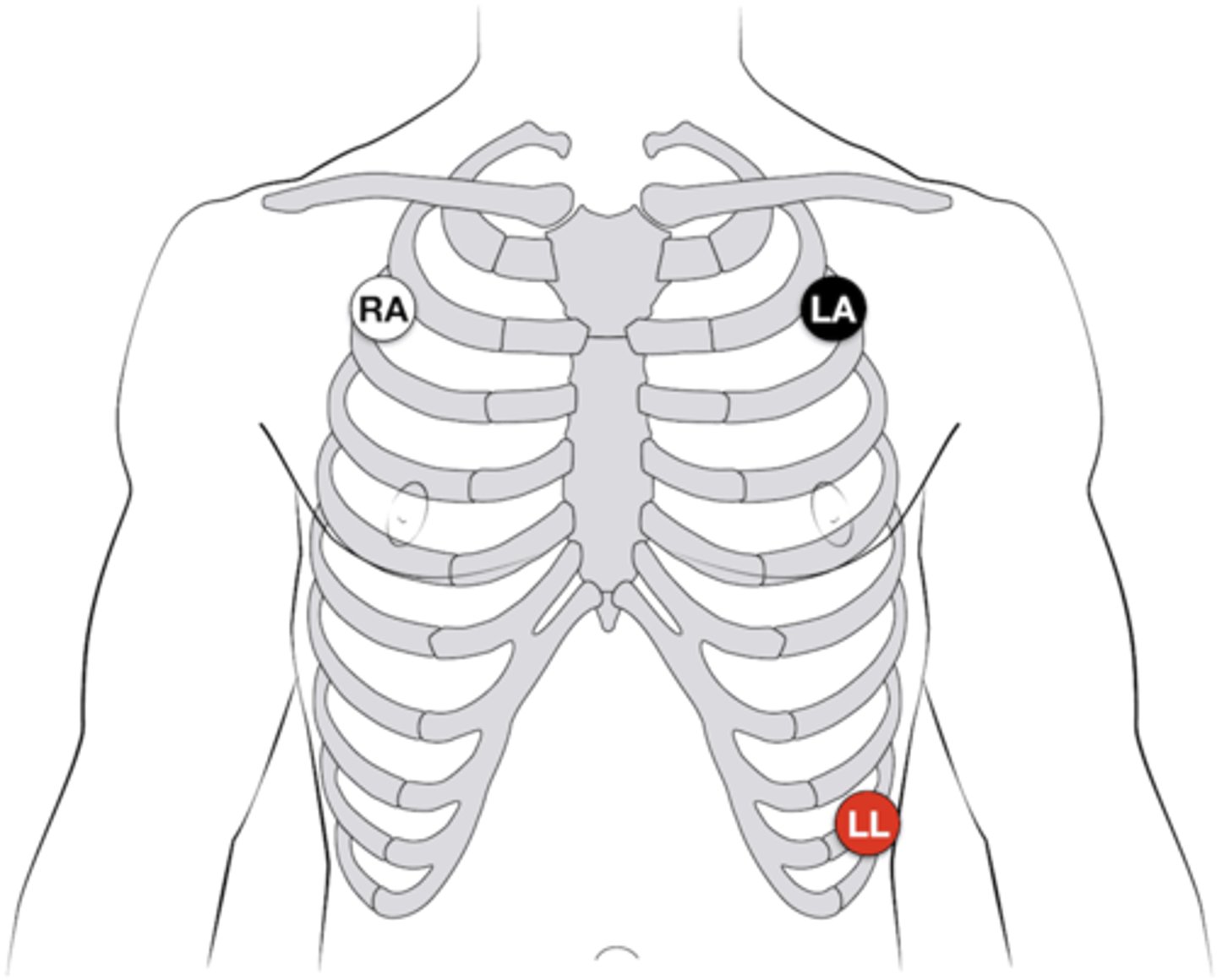 <p>on the right shoulder, the left shoulder, and the left abdomen</p>