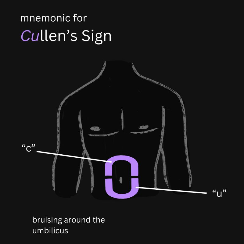 <p>Bruising around the umbilicus, </p><ul><li><p>sign of intraperitoneal hemorrhage</p></li></ul><ul><li><p>Pancreatitis or ectopic pregnancy</p></li><li><p>“Umbili<u>cullen</u>”</p></li></ul><p></p>