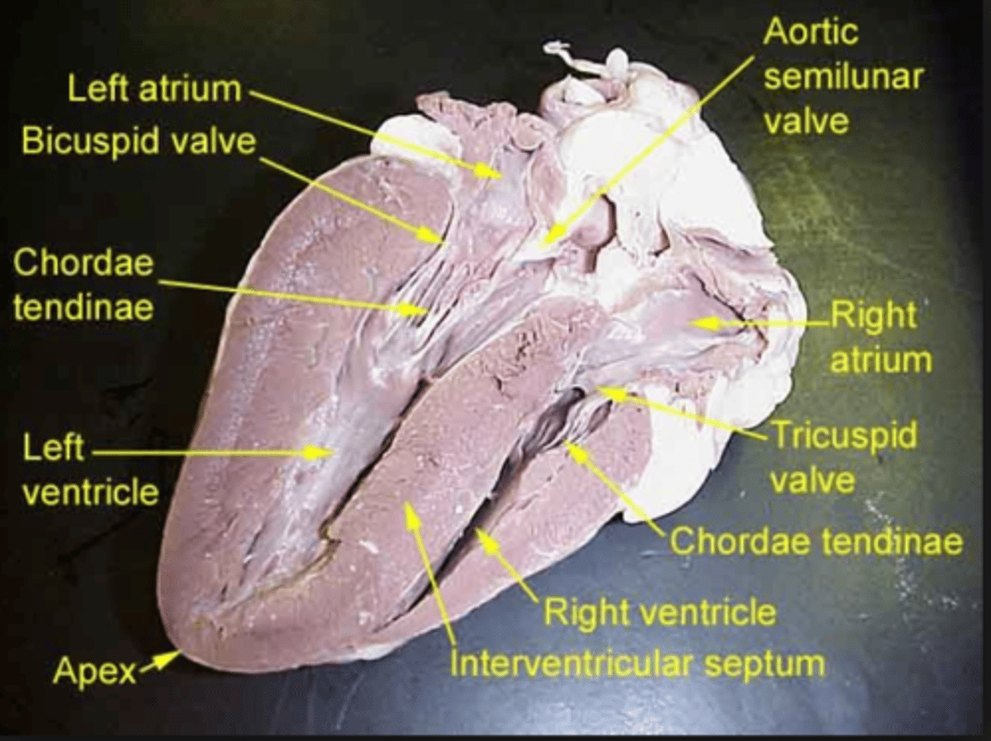 <p>holds AV valves in place while the heart is pumping blood</p>