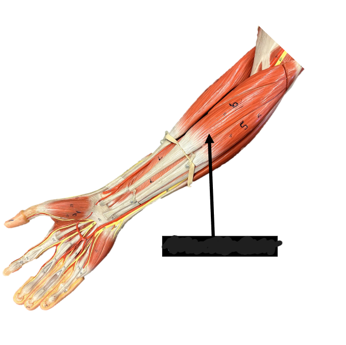 <p>Origin: medial epicondyle of humerus</p><p>Insertion: base of the 2nd and 3rd metacarpals</p><p>Function: flexes hand at the wrist&nbsp;</p>