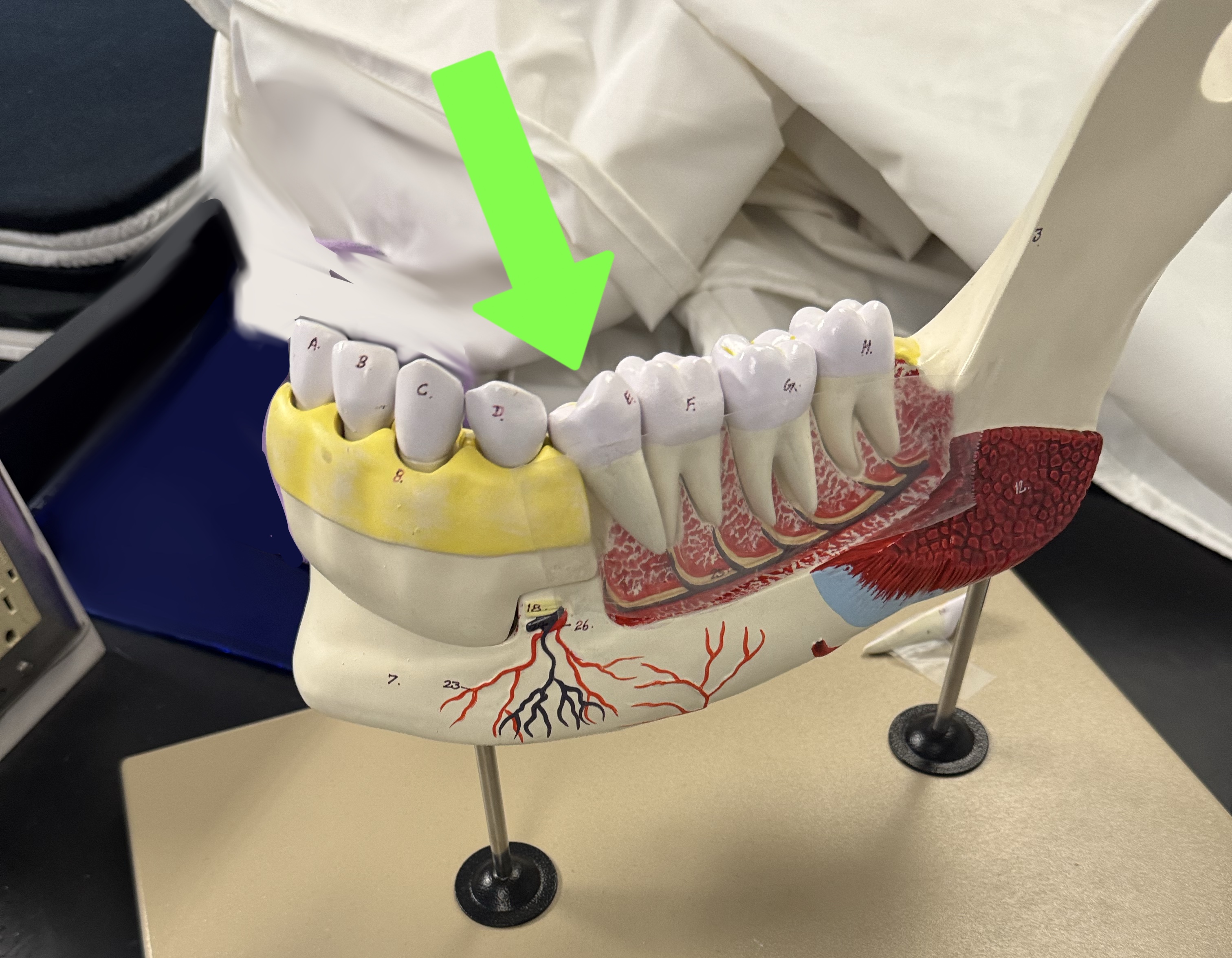 <p>what type of tooth is this</p>