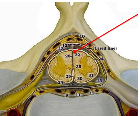 <p>anterior median fissure, central sulcus, spinal fissure, or posterior median fissure</p>