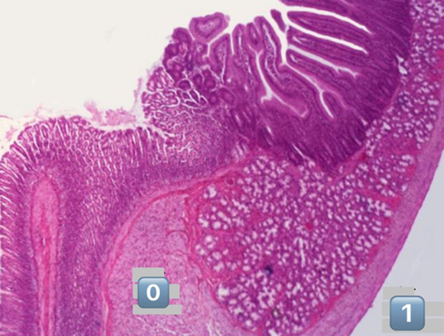 <p>gastroduodenal junction</p>