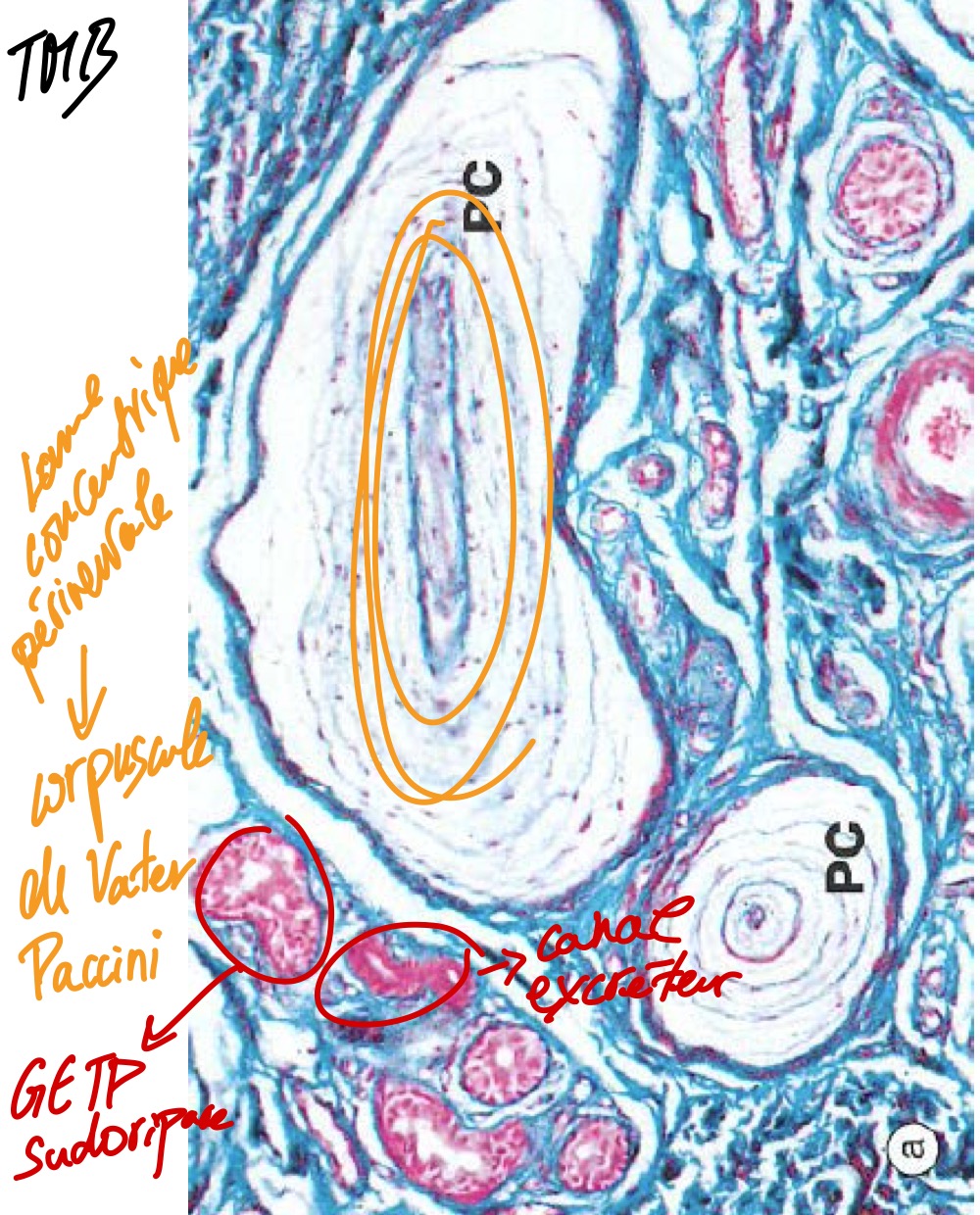 <p>MO, paraffine, TMB</p><p>Terminaisons nerveuses sensitives encapsulées sans support Corpuscule de Vater-Paccini (lame concentrique péicentrale) </p><p>Glande exocrine tubuleuse pelotonné sudoripare (canal excréteur) </p>