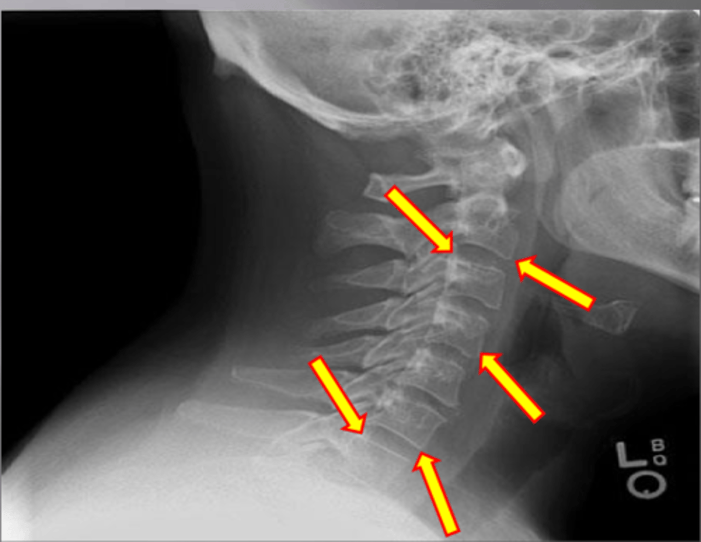 <p>What feature is shown here?</p>