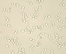 <ol start="50">
<li>What do yeast cells look like?</li>
</ol>