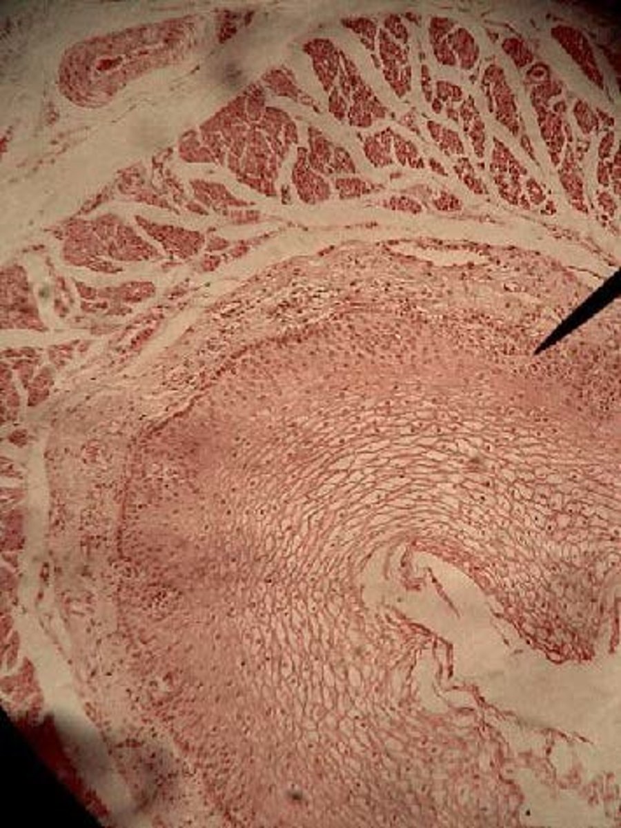 <p>Location with keratinized surface rough Epidermis (skin)</p><p>Location with non keratinized surface smooth oral, esophagus, vagina, anal canal</p>