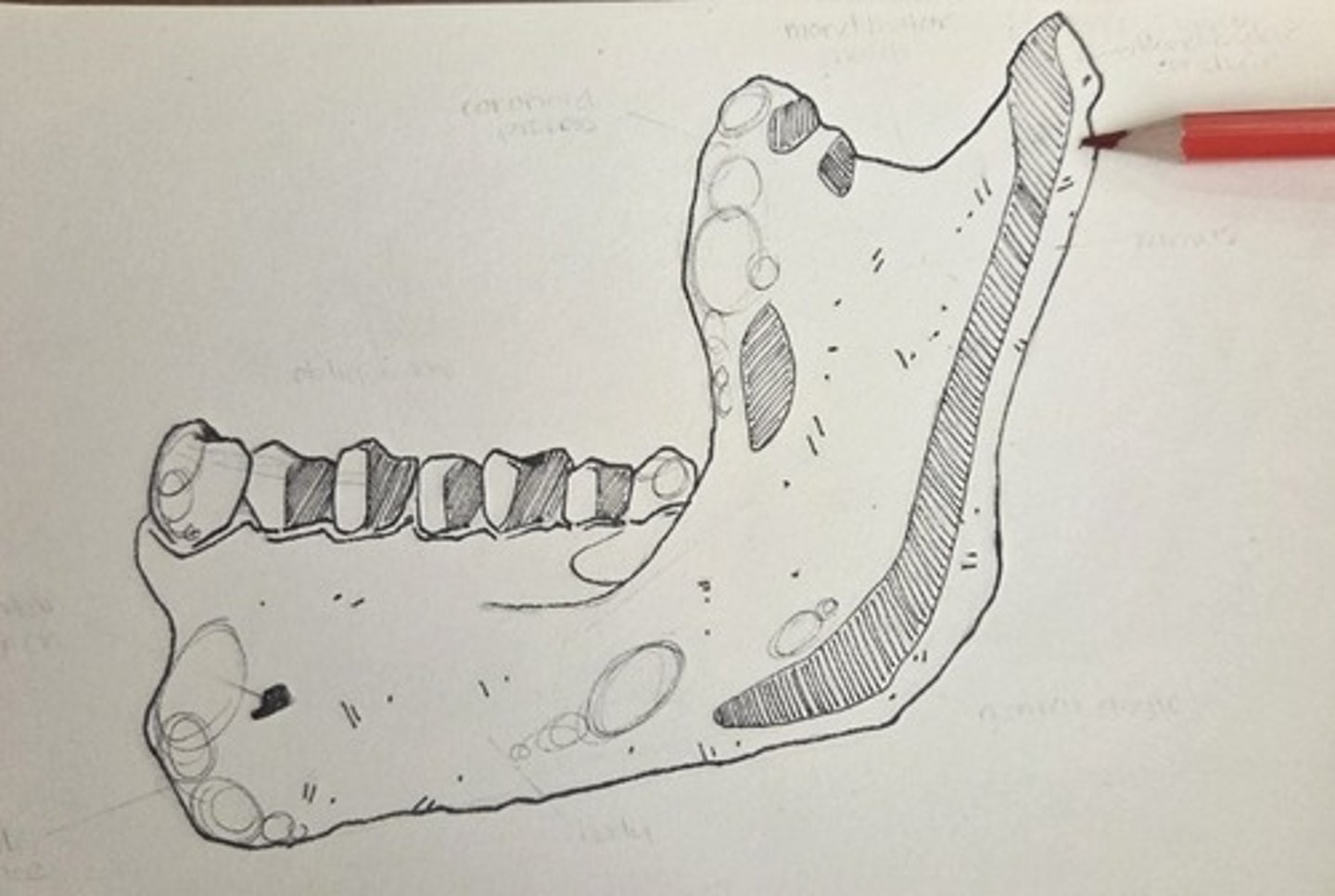 <p>the area just anterioinferior to the condyle</p>