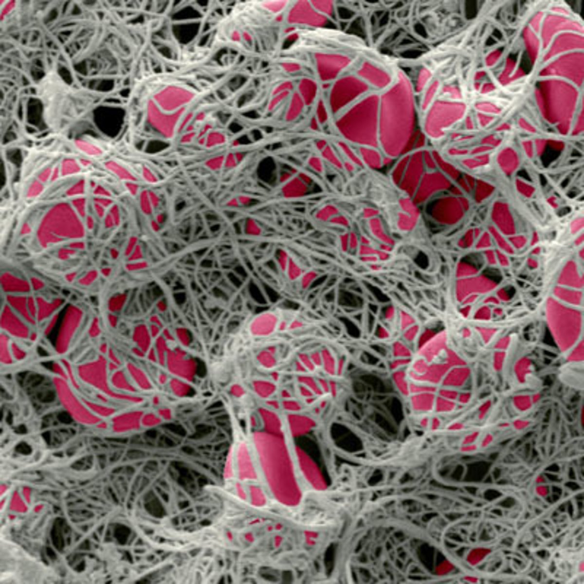 <p>any of the various plasma components involved in the clotting process</p>