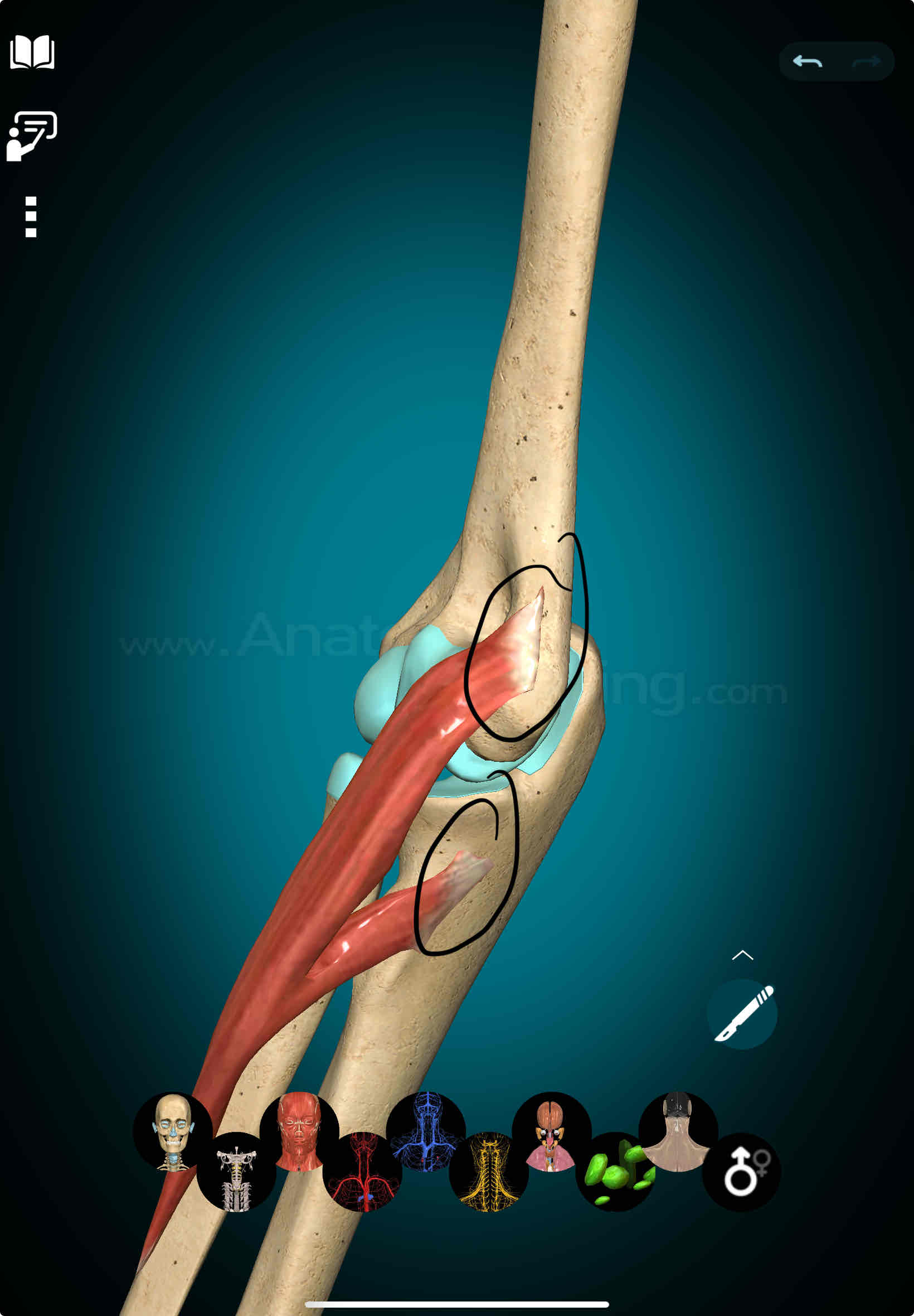 <p>Pronator Teres Origin </p>