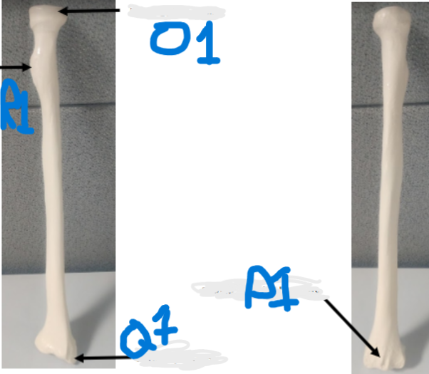 <p>What is Q1? on the radius bone</p>