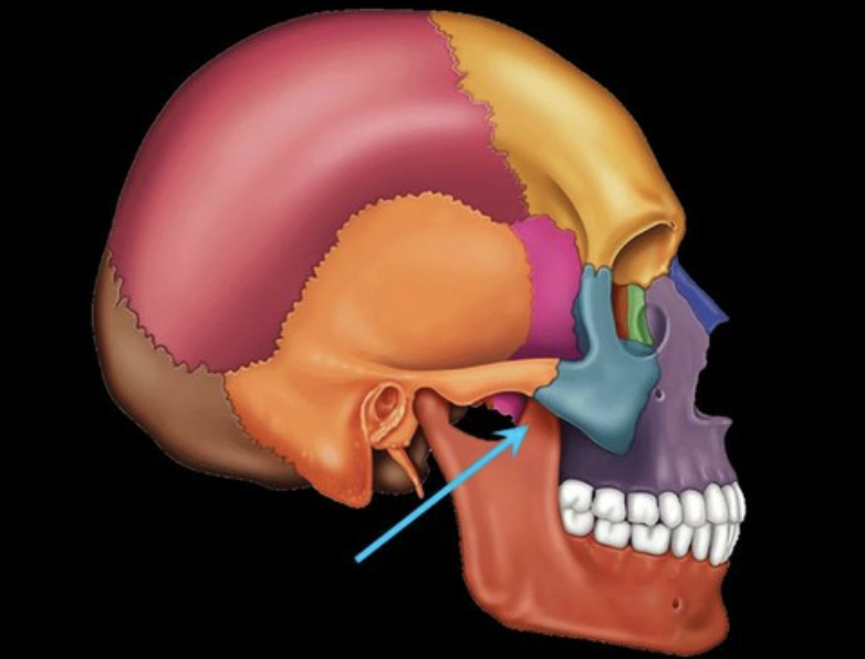 term image