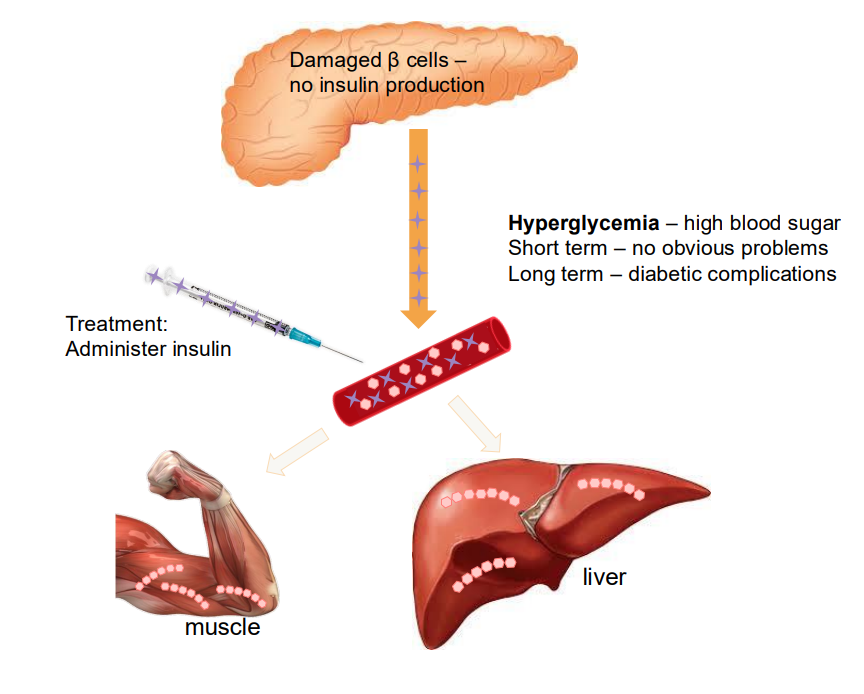 <p>Damaged Beta cells</p>