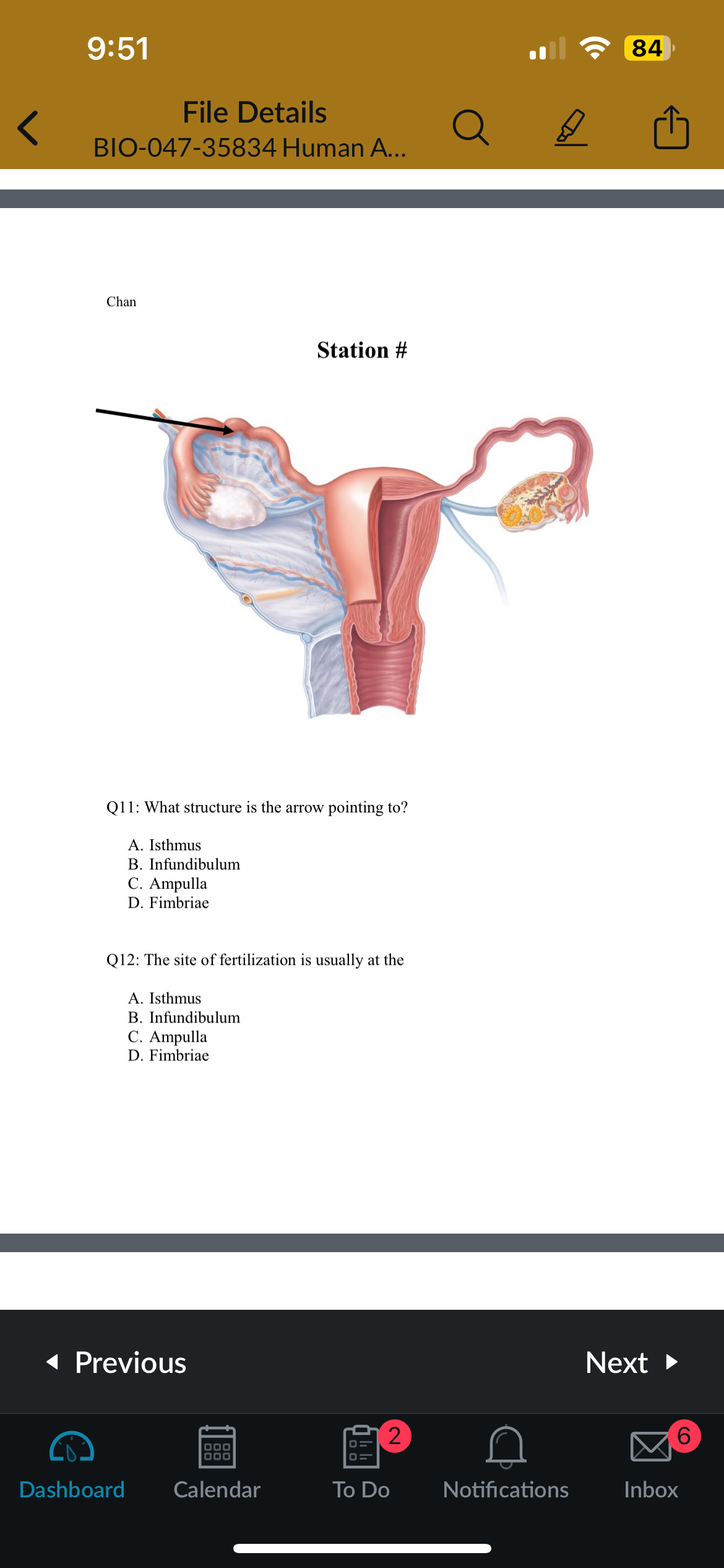 <p>Q12: The site of fertilization is usually at the?</p>