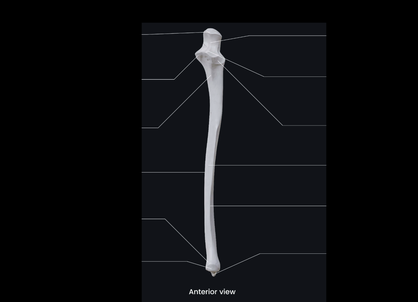 <p>this bone</p>