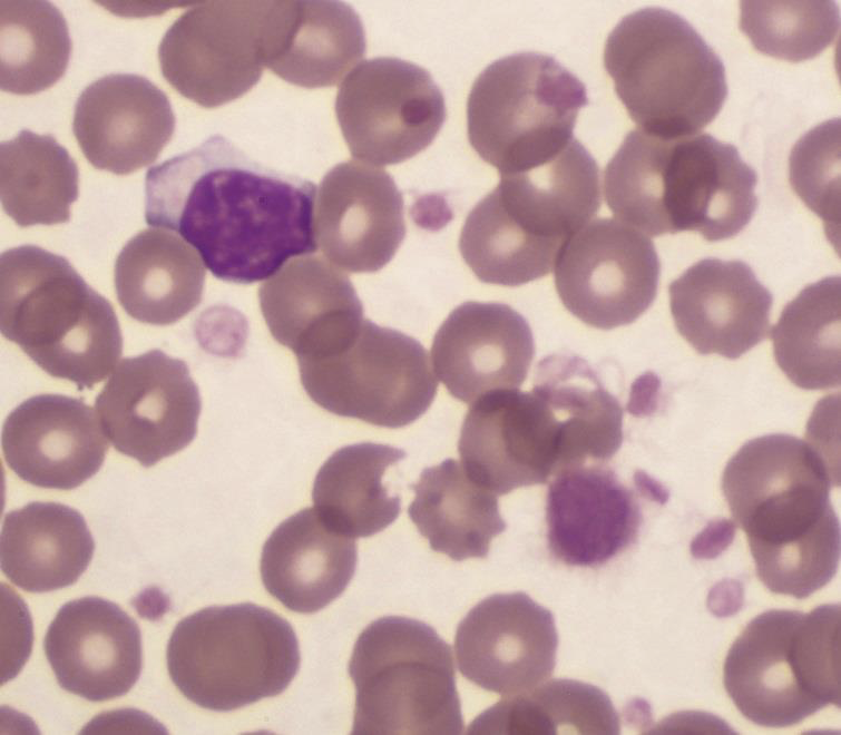 <p>what is the bottom purple thing</p>