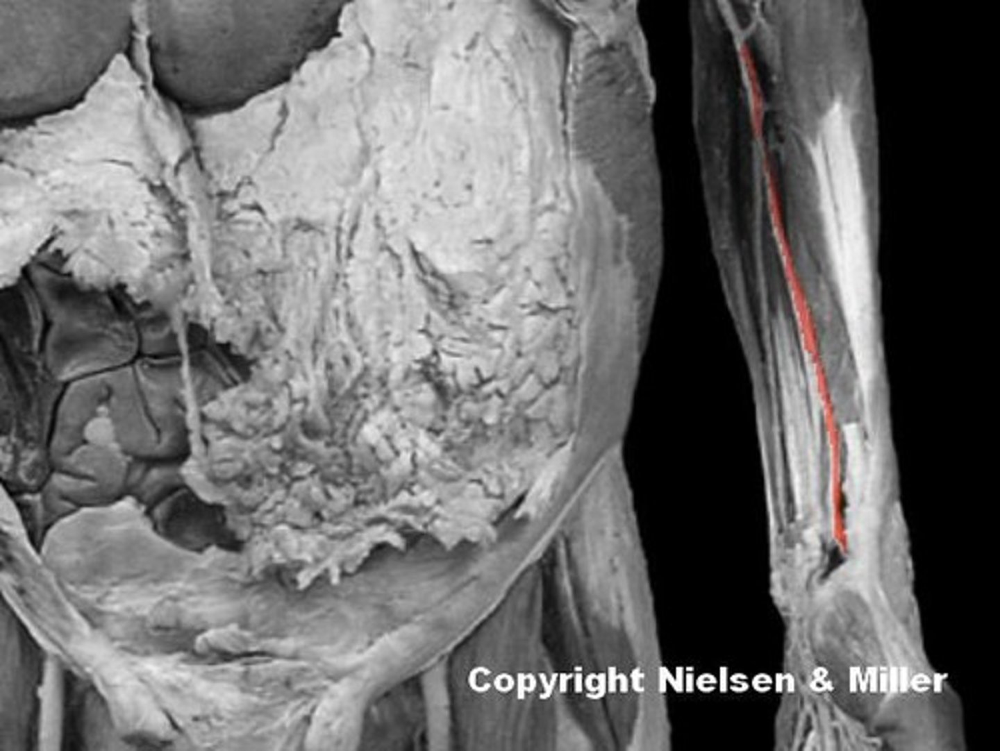 <p>dentify the regions supplied by the highlighted vessel.</p>