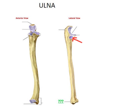 <p>ulna, lil dent on edge of “C”</p>