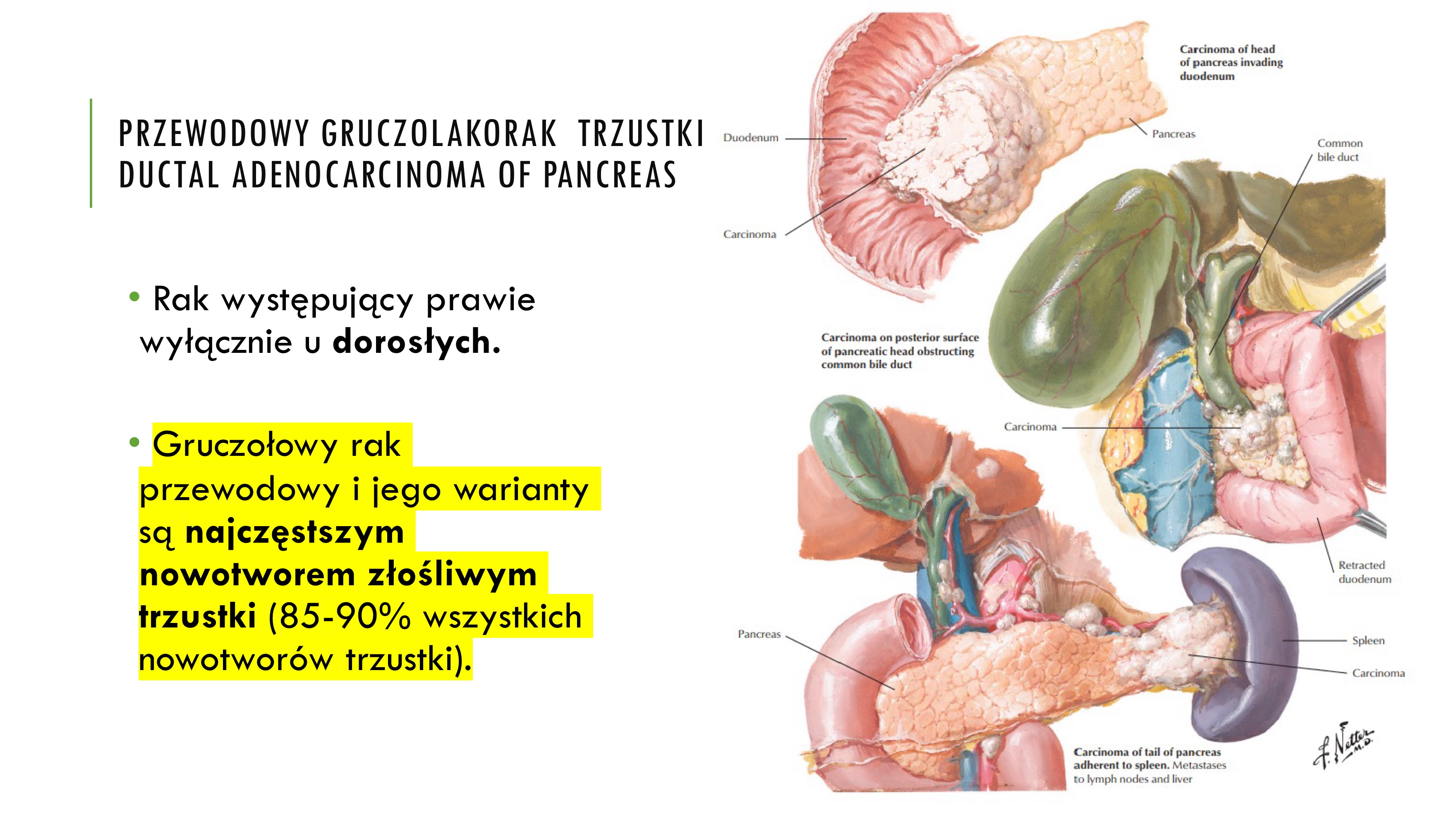 <p>Gruczołowy rak</p><p>przewodowy i jego warianty</p><p>są najczęstszym</p><p>nowotworem złośliwym</p><p>trzustki (85-90% wszystkich</p><p>nowotworów trzustki).</p>