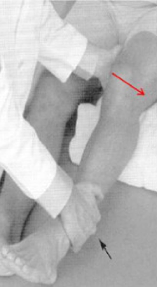 <p>Which special test is this? What does it test?</p>