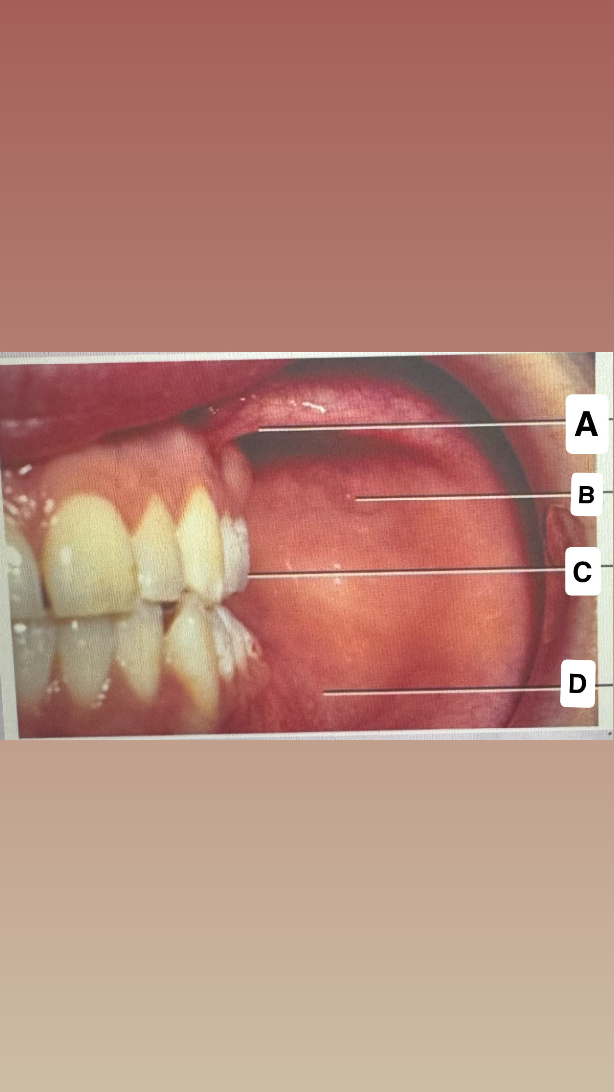 <p>Identify A</p>