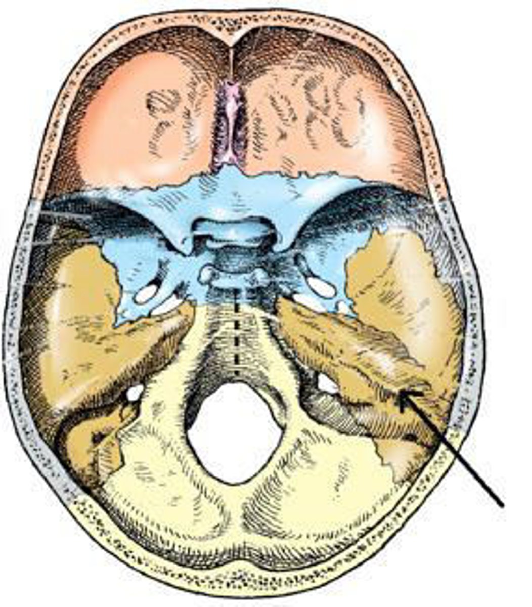 <p>d. petrous portion.</p><p>3 multiple choice options</p>