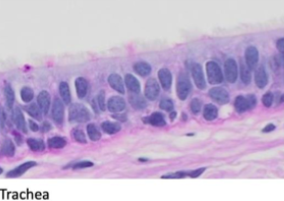 <p>Angiv epitheltypen</p>