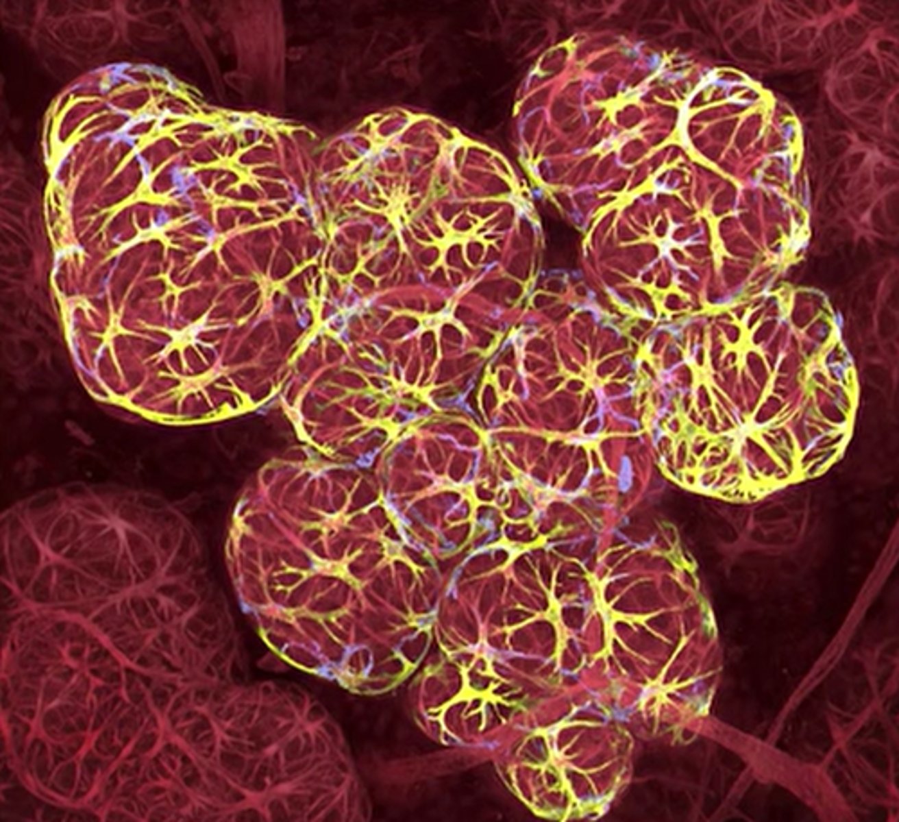 <p>breast tissue in lactation</p>