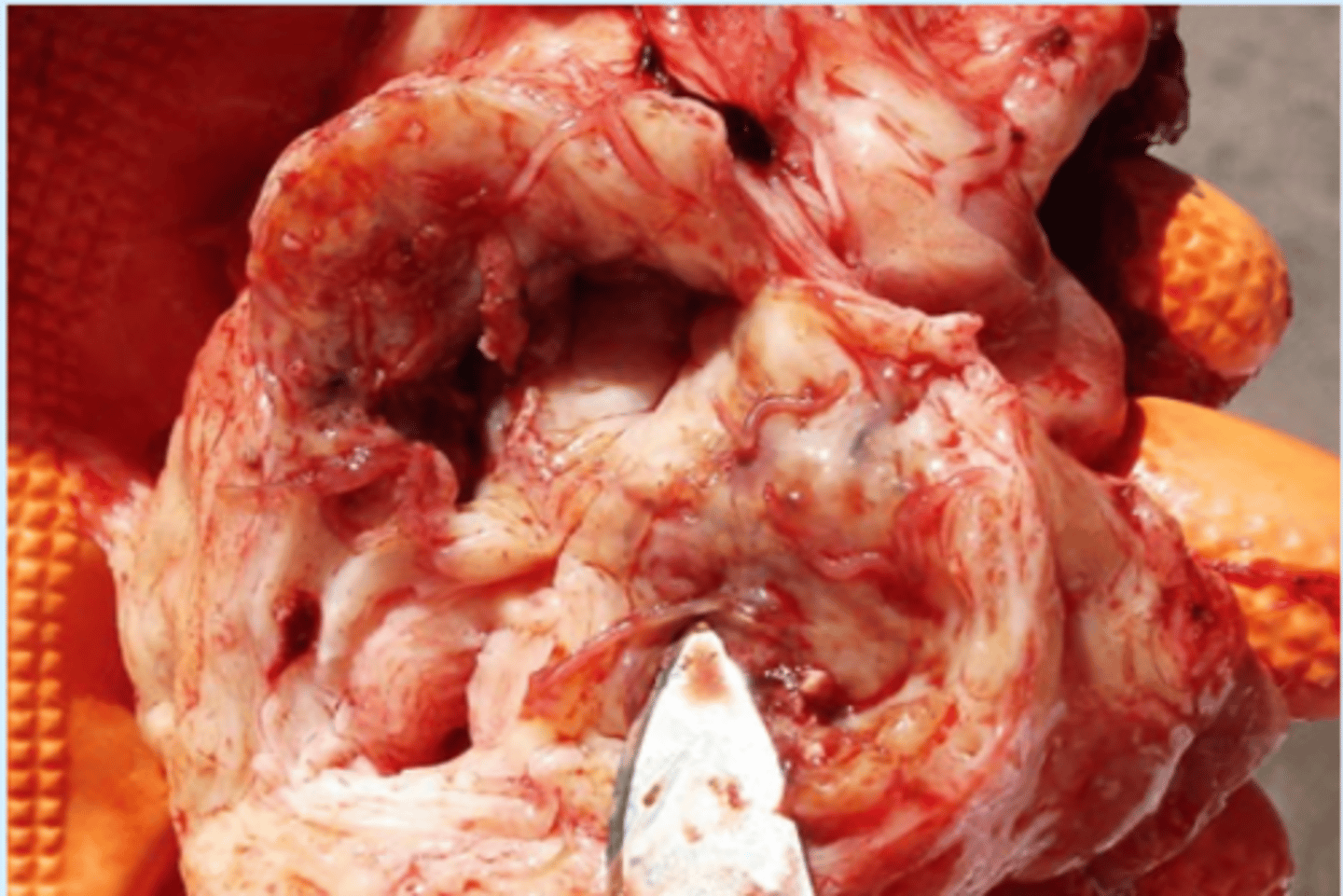 <p>aorta of a horse. what parasite is this?</p>