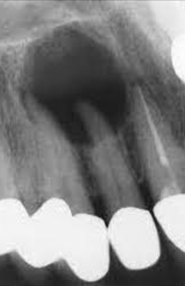<p>What is the dental anomaly?</p>