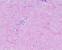 <p>Structure: Less ground substance, lots of collagen, fibroblasts and fibrocytes, vascular</p>