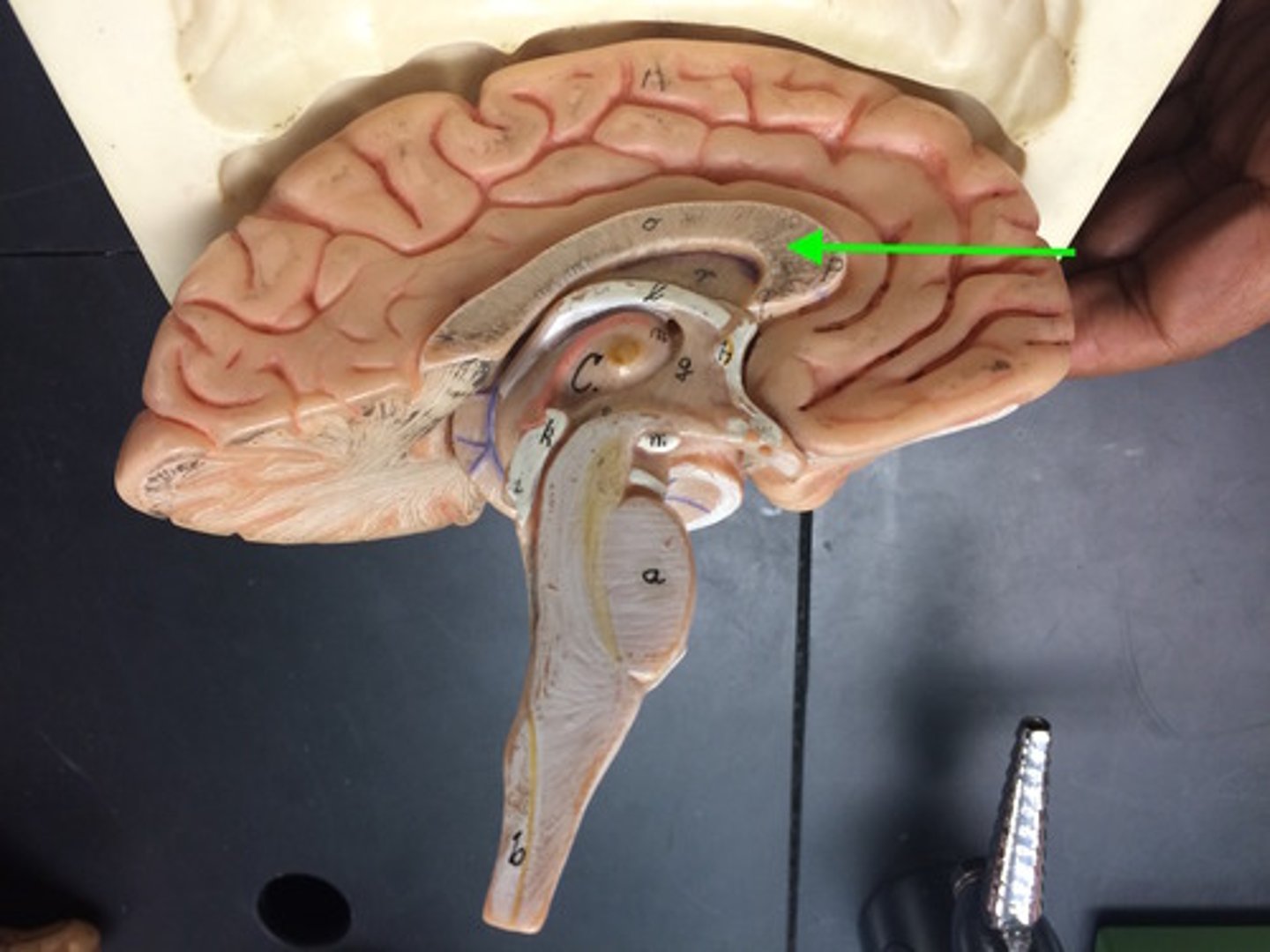 <p>the large band of neural fibers connecting the two brain hemispheres and carrying messages between them</p>