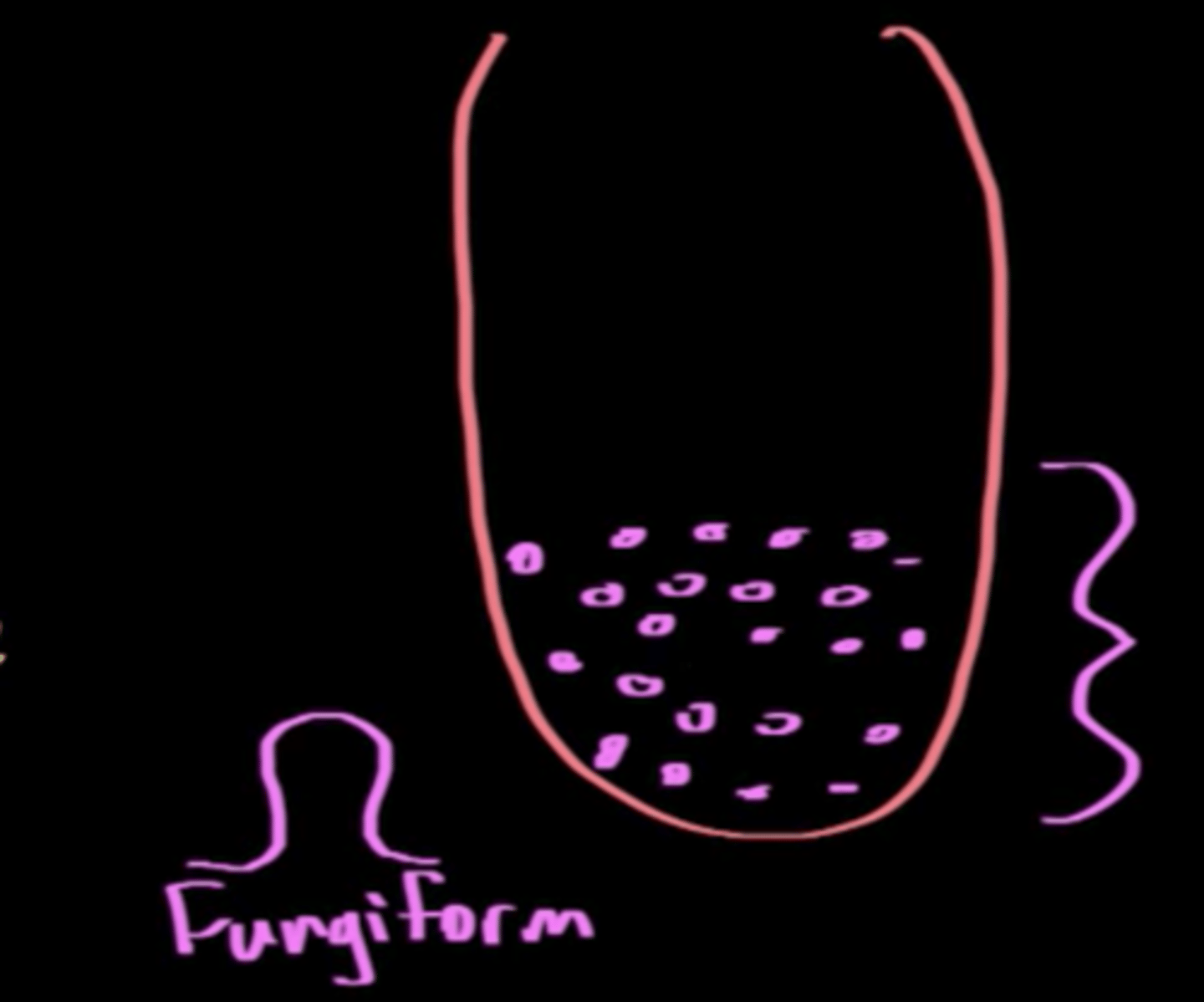 <p>(A) Fungiform</p><p>Fungiform taste buds are mushroom shaped structures located primarily in the anterior portion of the tongue.</p>