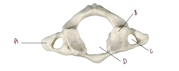 Give the specific name for this CERVICAL vertebra
