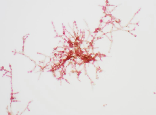 <p>Fonsecaea Pedrosoi</p>