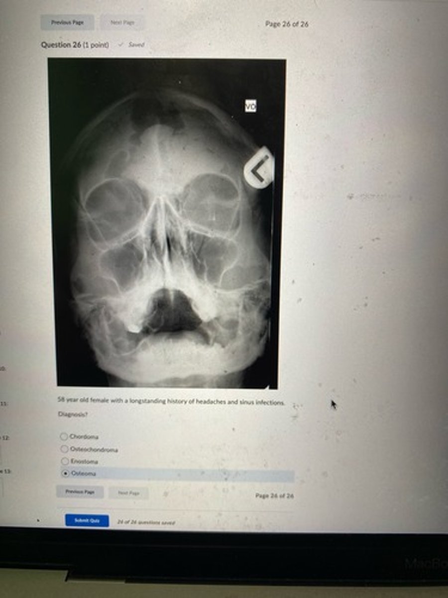<p>Osteoma</p><p>3 multiple choice options</p>