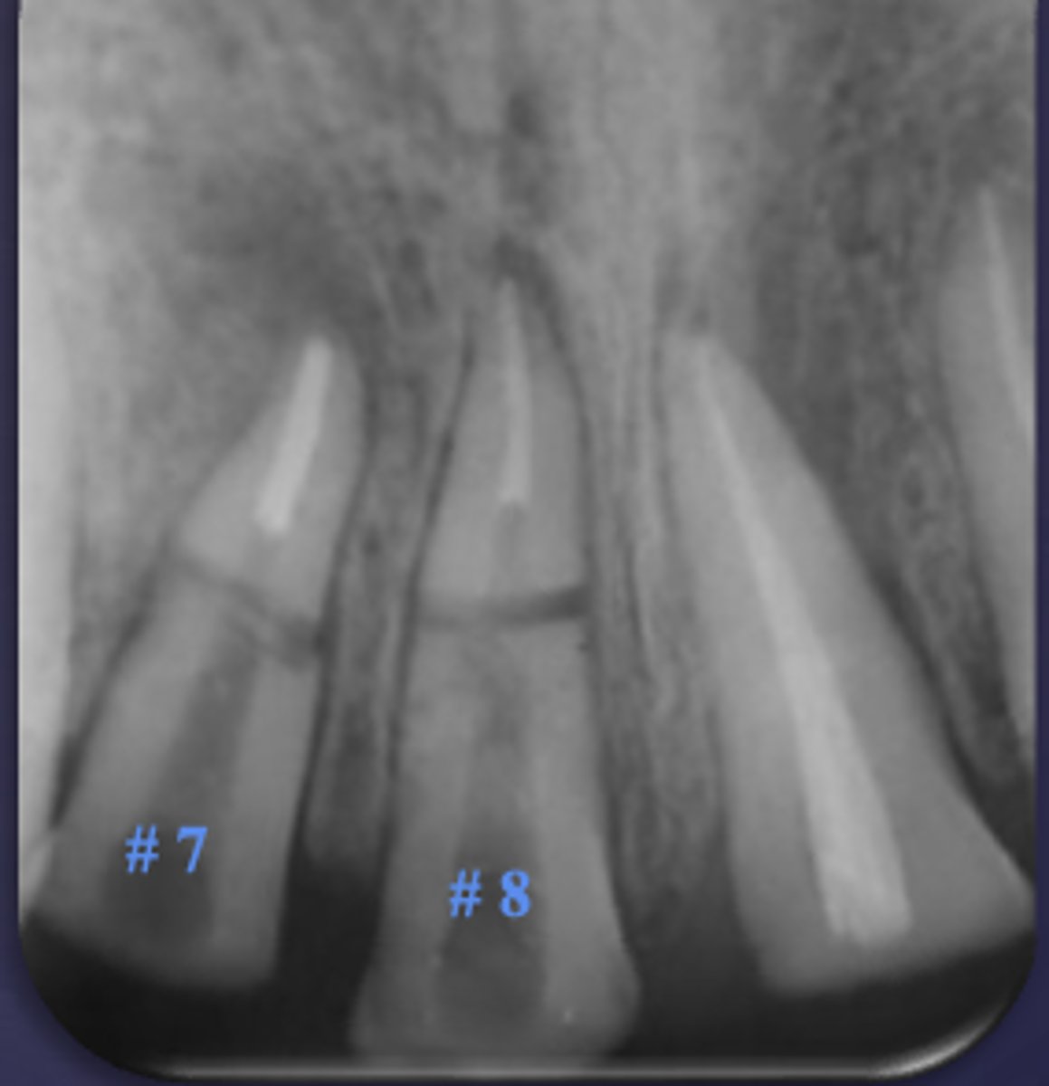 <p>ID the condition:</p>